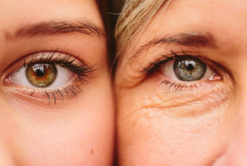 Droopy eyelids or saggy eyelids treatment