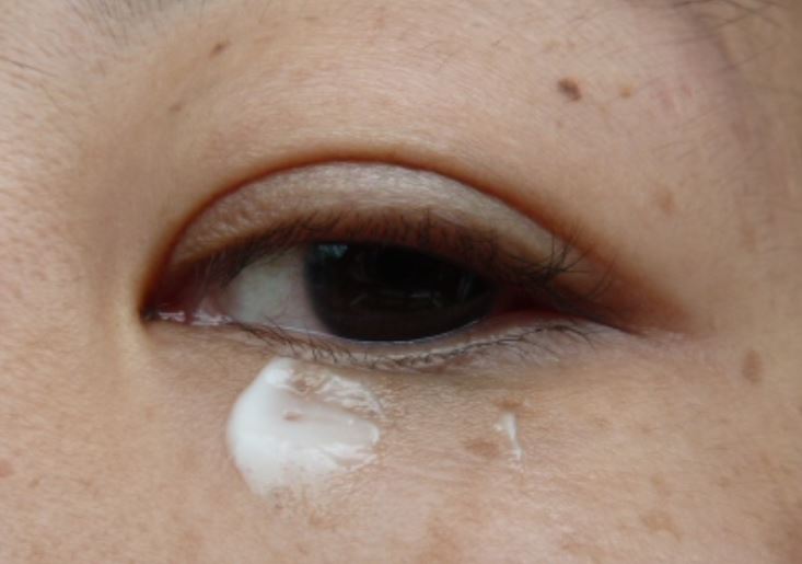 Hiding dark spots under eyes