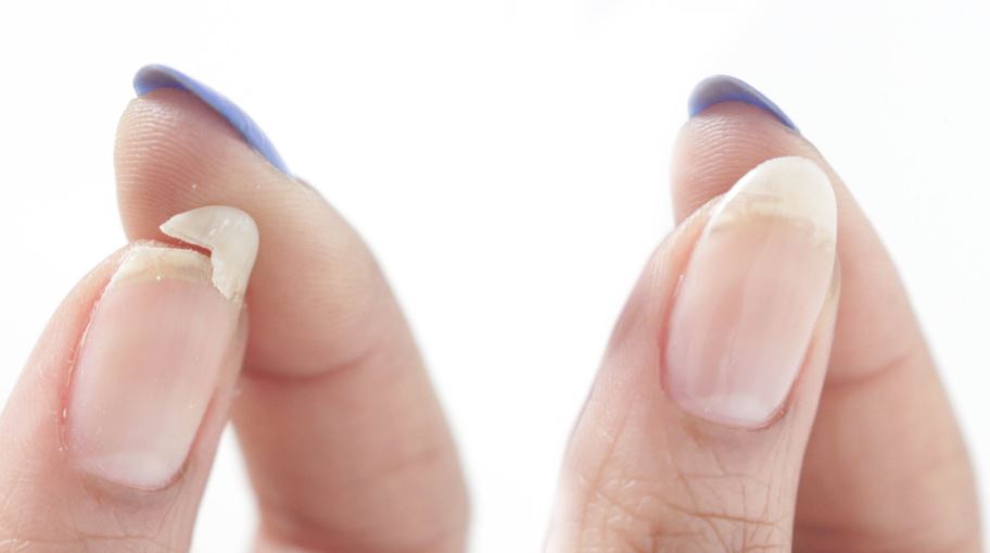 Tutorial to fix a broken nail