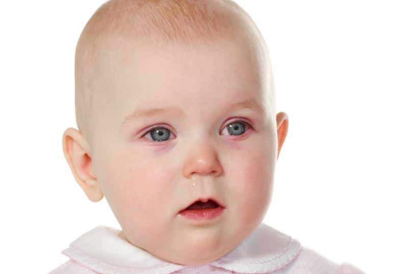 Red eyes in babies - pink eye