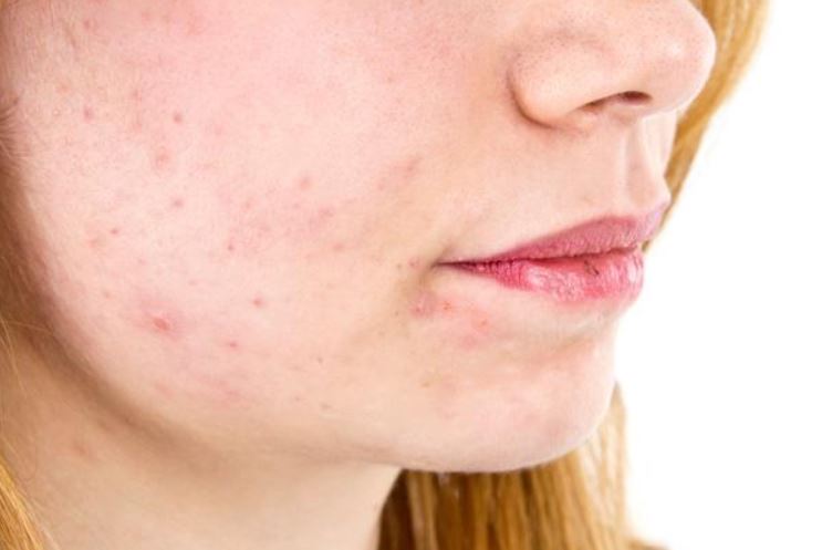 Why is my left or right jaw swollen